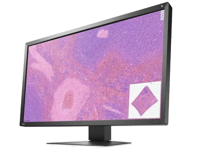 EIZO PX3150 pathology display