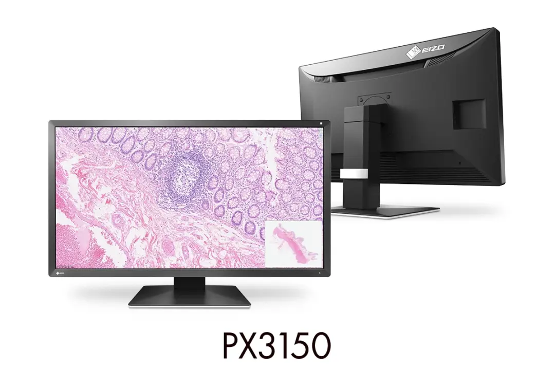 EIZO PX3150 pathology display ships with DCI 4K and FDA certification